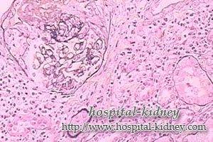 Lupus nefritis kan kureres