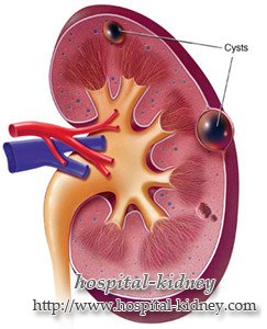 Grundlæggende viden om nyre cyste