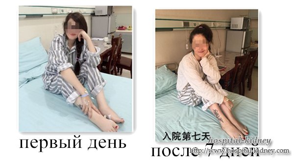 Пациент из России с нефротическим синдромом