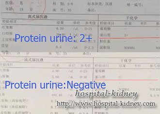 Как лечить протеиновую мочу 2+ до - с естественным лечением