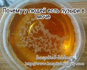 Почему у людей есть пузыри в моче