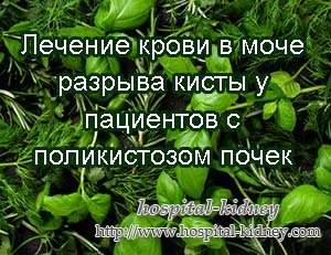 Лечение крови в моче разрыва кисты у пациентов с поликистозом почек