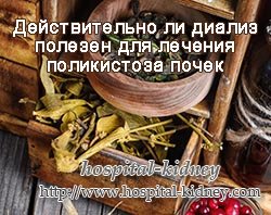 Действительно ли диализ полезен для лечения поликистоза почек